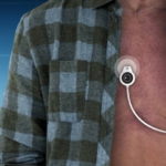 “S-Patch Cardio” เทคโนโลยีอ่านคลื่นไฟฟ้าหัวใจแบบเรียลไทม์สำหรับผู้ป่วยโรคหัวใจ, Whale Energy Station