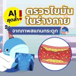 AI สุดล้ำ! ตรวจไขมันในร่างกาย จากภาพสแกนกระดูก, Whale Energy Station